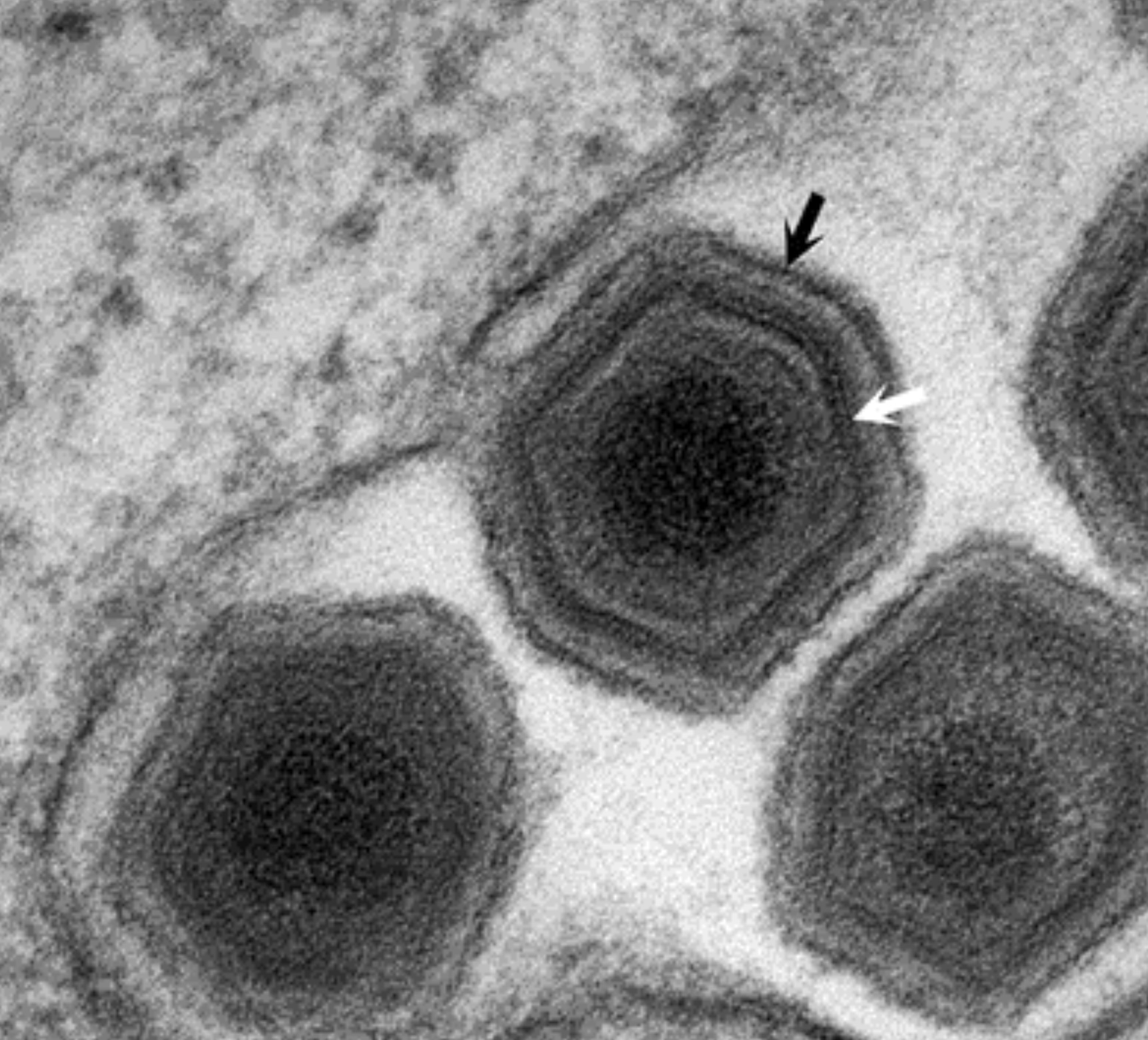 Asfarviridae