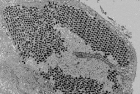 Nimaviridae