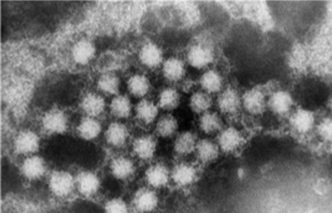 Hepeviridae