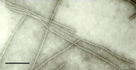 Betaflexiviridae EM